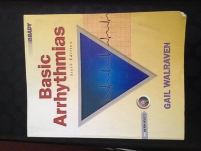 Basic Arrhythmias
