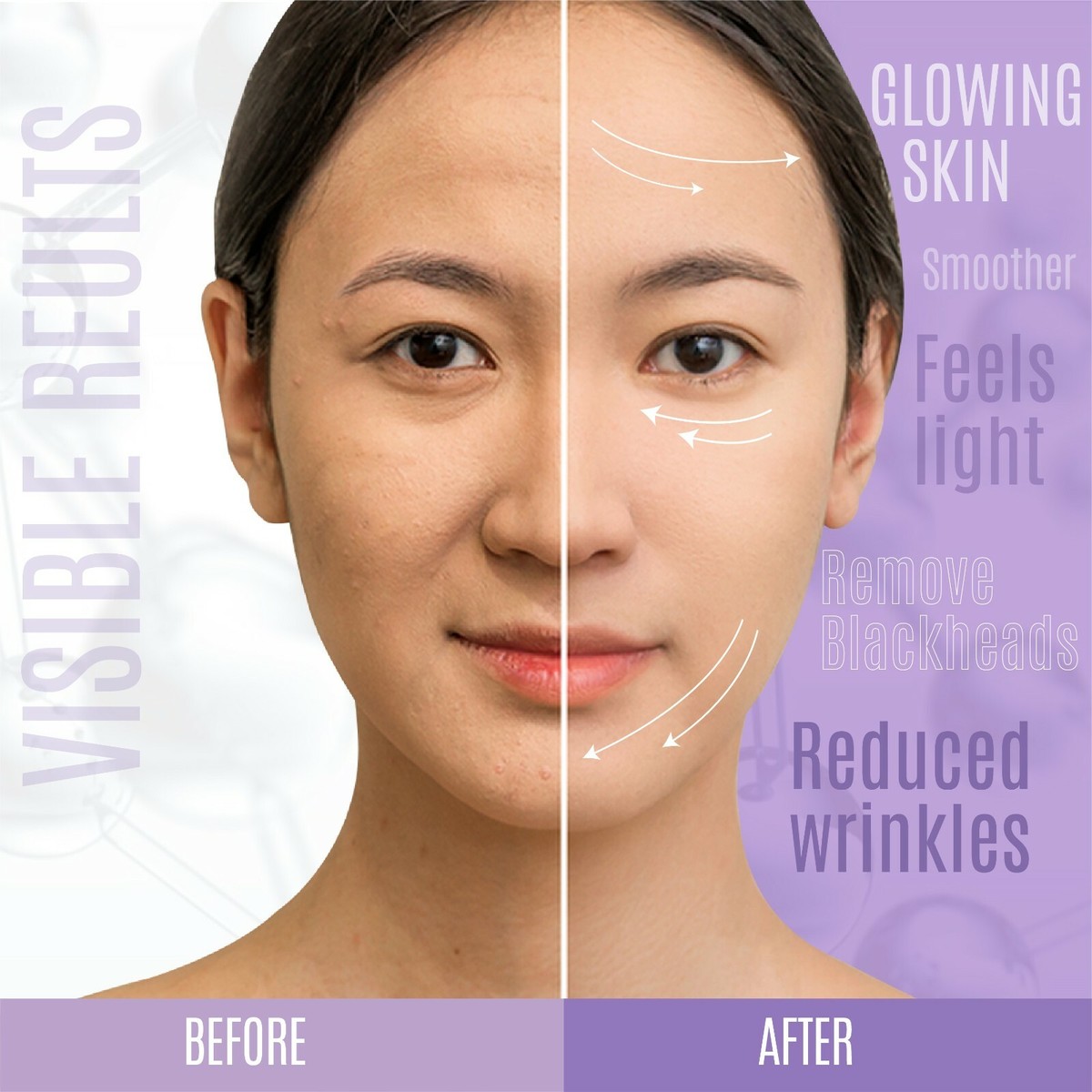 Firming,Wrinkle Remover Matrixyl 3000, Peptide Boost, Hyaluronic Firming,Wrinkle Remover Matrixyl 3000, Peptide Boost, Hyaluronic