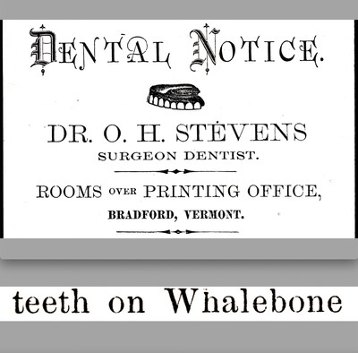 Teeth on Whale Bone Dr Stevens Surgeon Dentist VT Victorian Trade Card SR.M.wt