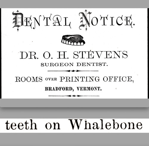 Teeth on Whale Bone Dr Stevens Surgeon Dentist VT Victorian Trade Card SR.M.wt