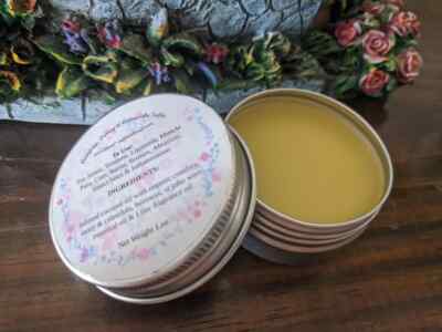 Calendula Salve / Balm Diaper rashes-itchy skin, Cuts, Burns & so much more...