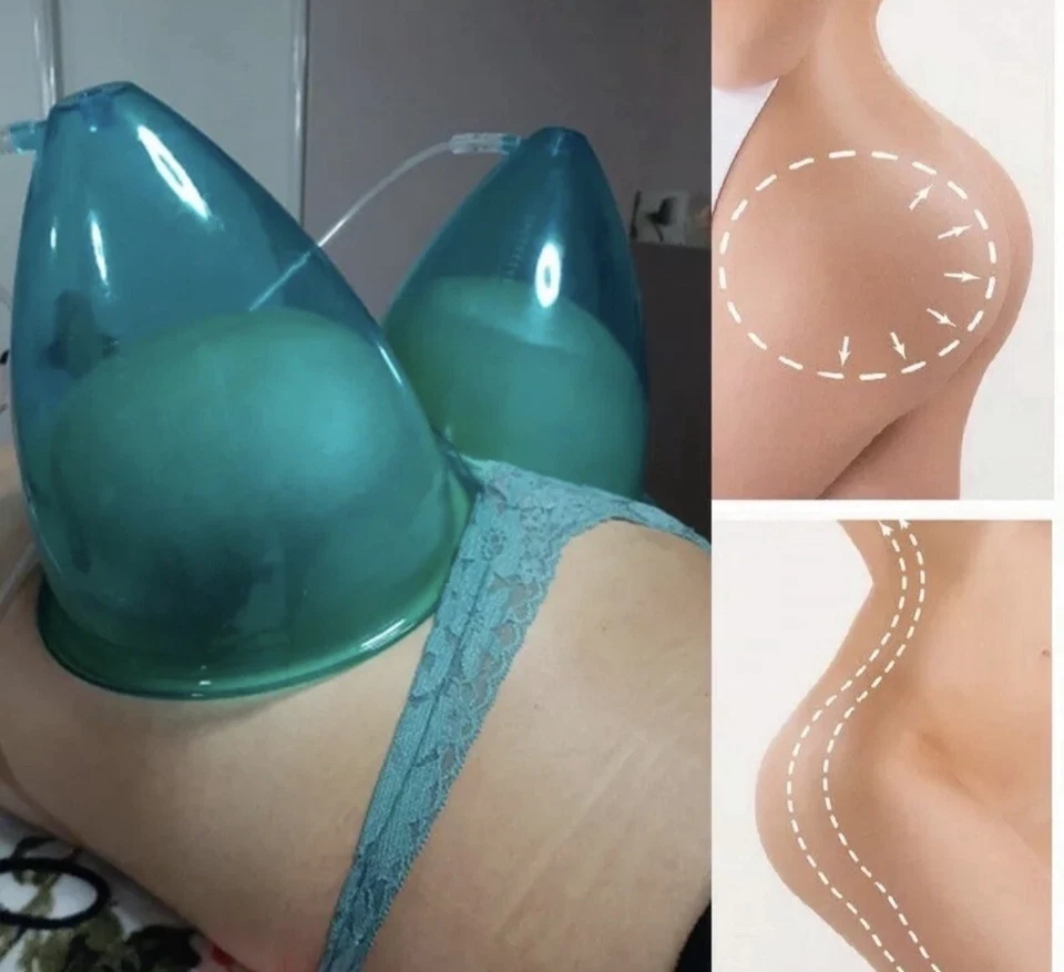 FREE SHIPPING Xxxl vacuum cups, FREE SHIPPING, other sizes available - Image 2 of 4