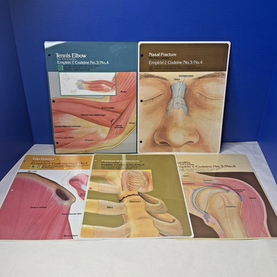 Codeine Medical Charts 5 Drug Rep Ad Promo Pharma Collectible Marketing 1980