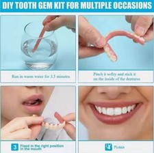 Self-Fit Boil  Bite Denture for Narrow or Wide Arches - Confidence at Home