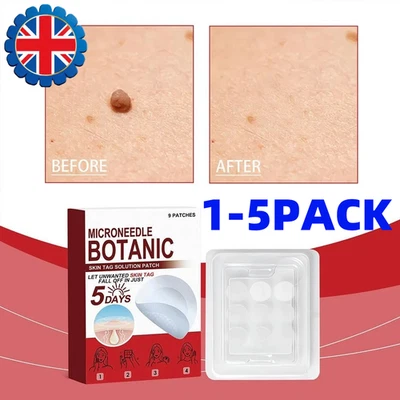1-5 BOX MICRONEEDLE BOTANIC Skin Tag & Acne Patch 9 Pcs Skin Tag Remover Patches