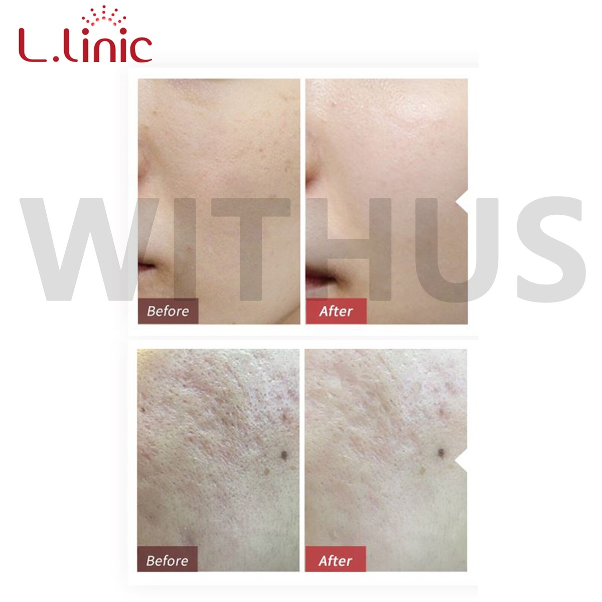L.linic Intensive LED Mask L.LINIC360 Scalp &Face Total care