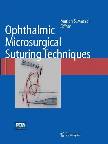 Ophthalmic Microsurgical Suturing Techniques by Marian S. Macsai - 9783662500316