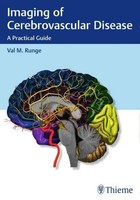 Imaging Of Cerebrovascular Disease Val M Runge