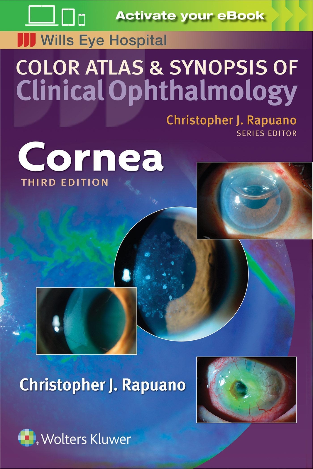 Thumbnail - Cornea (color Atlas And Synopsis Of Clinical Ophthalmology) Rapuano