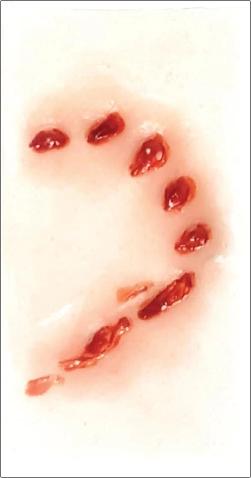 Kit de transferencia Medium Glam Gore 3D FX - Love Bite, prótesis sin látex Foto 2 de 4