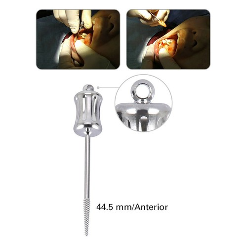 Dental Fragment Extraction Elevator Apical Root Tip Extractor Extracting Forcep - Picture 11 of 23