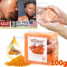 Tumeric Soap Skin Whitening Dark Spots lightening Acne Brightening Turmeric US