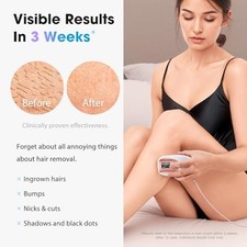 OREETH IPL Laser Hair Removal Device, 45 F Ice-Cooling, TM002 - Rose Gold