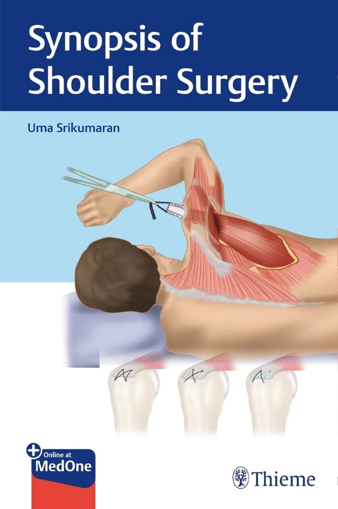 Thumbnail - Synopsis Of Shoulder Surgery Mit Online-zugang Uma Srikumaran Bundle