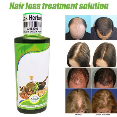The Best Hair Loss Treatment For Men And Women 100 Natural