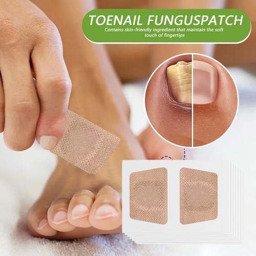 32* Nail Correction Stickers Nail Repair Patches Damaged Nail Care For Women Men - Picture 6 of 12