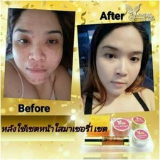 MACHE'RE MACHERE GOLD WHITENING CREAM SET BRIGHT BEAUTY SMOOTH SKIN DAY  NIGHT