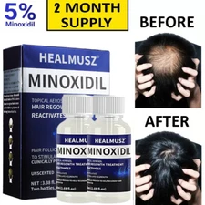 Minoxidil 5% Hair Regrowth Treatment Hair Loss & Growth Scalp Liquid For Men New