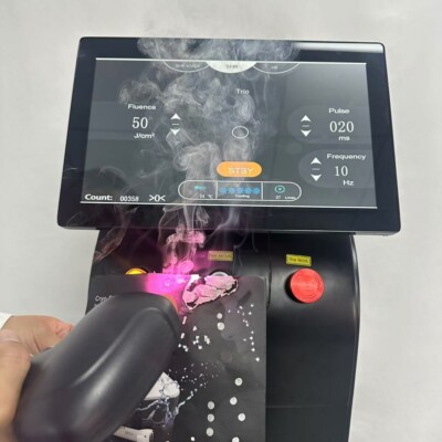 Laser Hair Removal Diferencia Entre Soprano Platinum Y Titanium