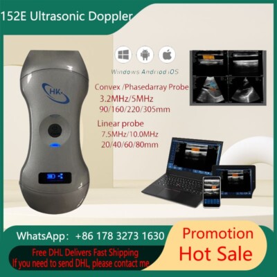 152E 3in1 portable Wireless Ultrasound scanner Wireless Color Ultrasound Doppler