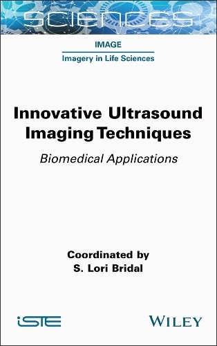 Innovative Ultrasound Imaging Techniques by S. Lori Bridal - 9781789451634