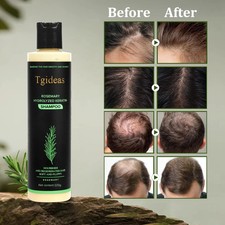 Tgideas Organic Rosemary Hair Growth Shampoo for Women and Men Natural Thicke UK