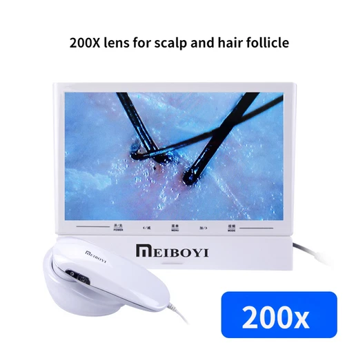 11'' Professional Hair Follicles Scalp Camera Digital Skin Microscope Camera - Picture 12 of 21