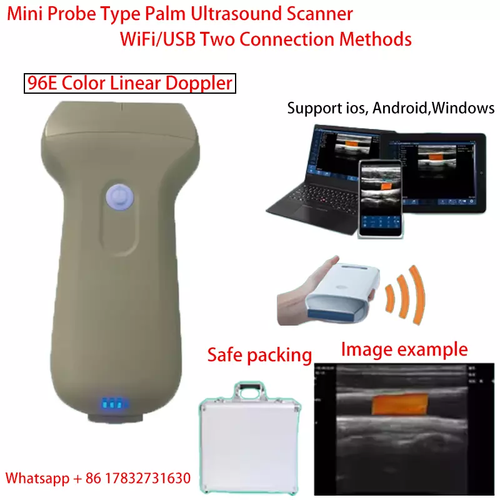 Sonda Doppler Lineare Portatile Wireless Ultrasuoni Connessione Wifi/USB 96E Colore - Foto 2 di 7