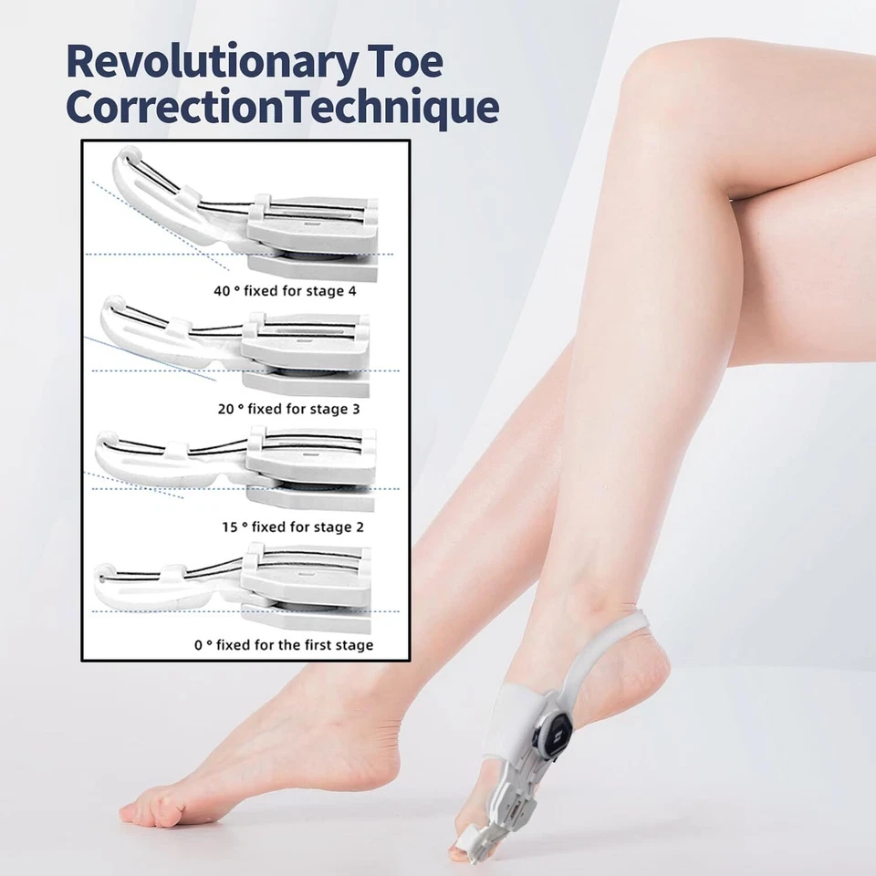 Separador de dedos Hallux Valgus juanete corrector ortopédico ajustador corrección deporte Foto 3 de 4