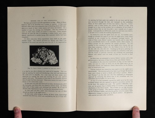 Anatomic and Physiologic Studies of the Eighth Nerve 1921 Ernest Sachs B. Alvis - Picture 7 of 9