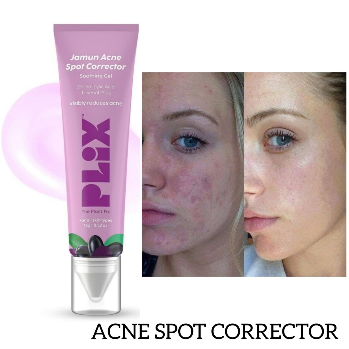 PLIX - THE PLANT FIX Jamun Acne Spot Corrector Gel For Reducing