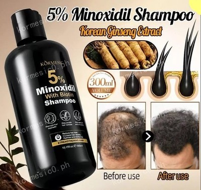 KORMESIC Minoxidil 5% Hair Grower Shampoo & Conditioner For Hair Loss 300 ml eac