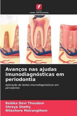 Avanos nas ajudas imunodiagnsticas em periodontia by Bebika Devi Thoudam (Portug
