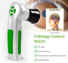 Digital Test System Camera 12.0MP USB Eye Iri...