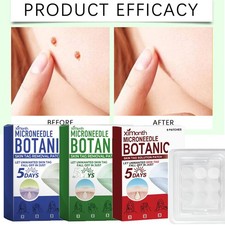 MICRONEEDLE BOTANIC Skin Tag  Acne Patch Skin Tag Remover Patches 9Pcs H OT