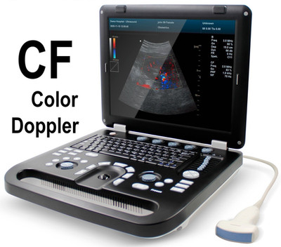 Digital Laptop Ultrasound Scanner - Portable Color Doppler System with Probe