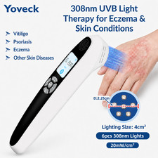 308nm Excimer UVB Phototherapy Lamp 6 Diodes for Face Hand Skin Treatment Home