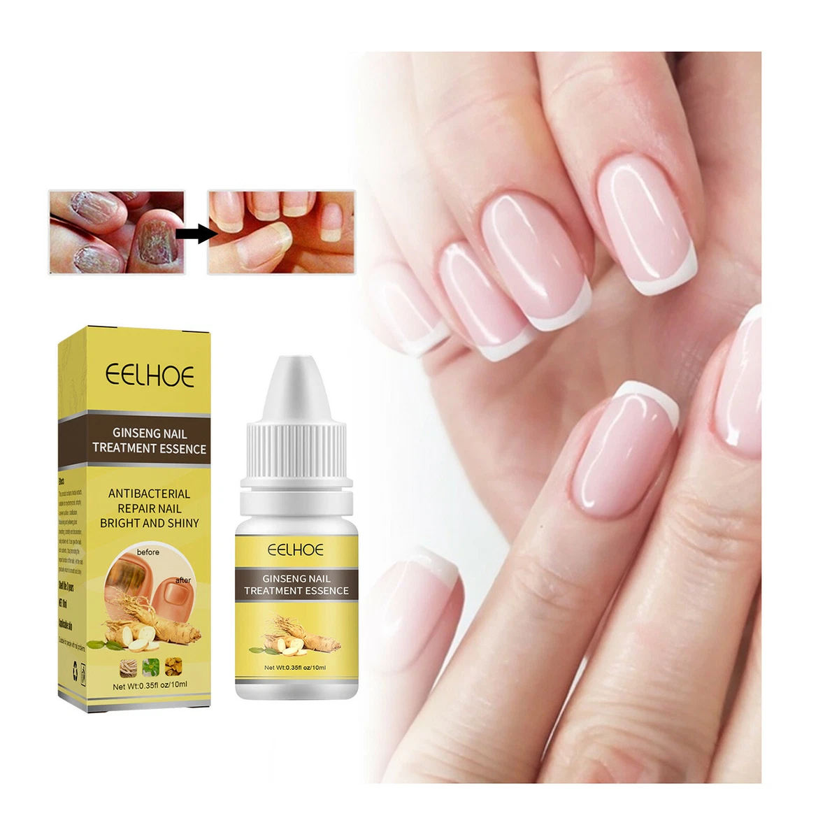 Discover 154+ healthy nail care products latest songngunhatanh.edu.vn