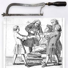 RARA SEGA DA AMPUTAZIONE XIX SECOLO CHIRURGIA SEGHETTO OSSA amputation bone saw