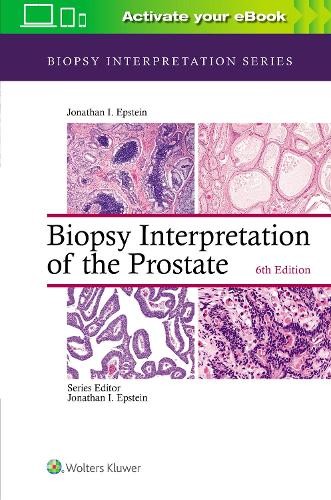 Biopsy Interpretation of the Prostate by Jonathan I. Epstein - 9781975136543