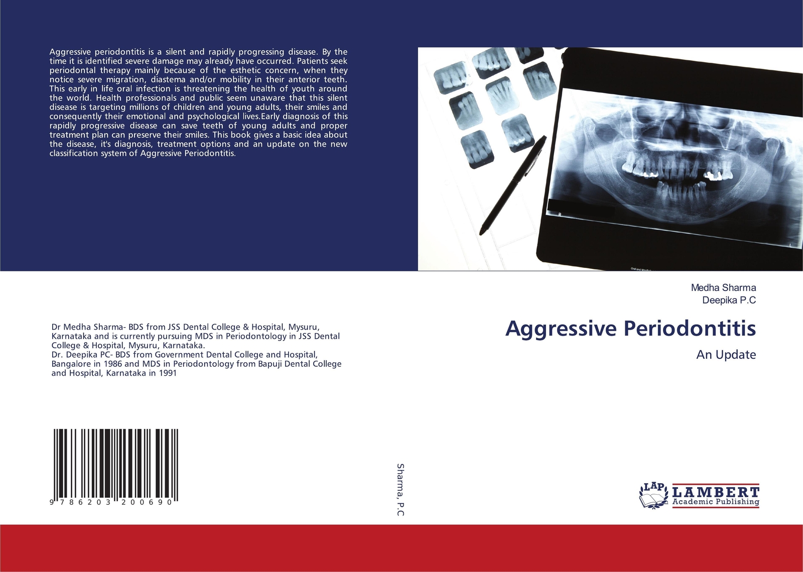 Thumbnail - Medha Sharma (u. A.) | Aggressive Periodontitis | Taschenbuch |
