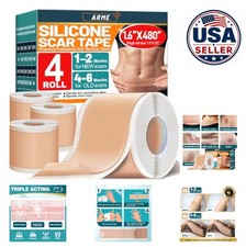 Silicone Scar Tape Sheets 4 Rolls 1.6 Inch x 480 Inch 12M Total Reusable