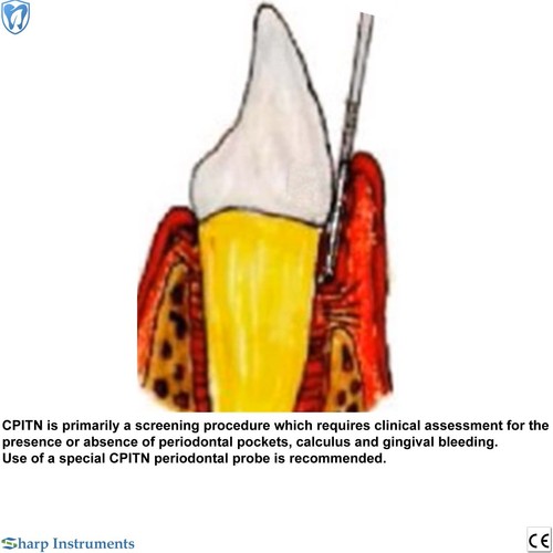 Dental Periodontal Probe CPITN Color Coded Hygienists Perio 3.5-5.5-8.5-11.5 mm - Picture 2 of 3