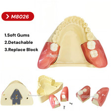 M8026 Impacted Wisdom Tooth Extraction Training Model Dental Tooth Oral Teaching