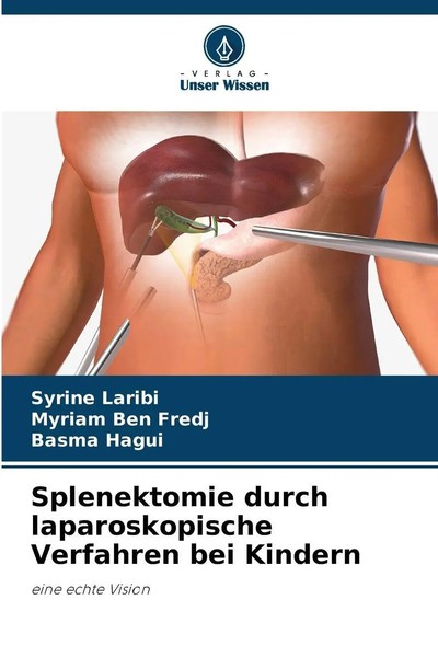 Splenektomie Durch Laparoskopische Verfahren Bei Kindern | Eine Echte Vision-image