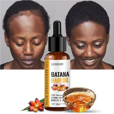 2pcs Lewedo Naturals Pure Batana Oil for Fast Hair Growth and Healthy Shine