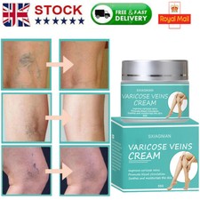 50g Varicose Vein Cream for Varicose Spider Legs Veins Treatment Natural Formula