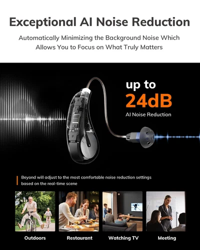-Más allá de los audífonos de venta libre, mejora del habla con IA y enmascaramiento del tinnitus,... - Imagen 2 de 9