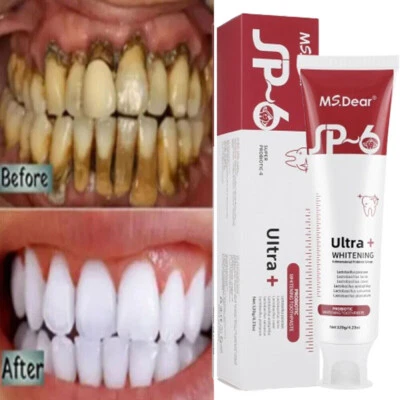 MS.DEAR Sp-6 Probiotic Brightening Toothpaste Whitening Fresh Breath Removal&Dental Care