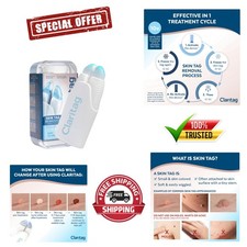 -Cleared Advanced Skin Tag Remover - 10 Cycles for Quick Results in 7-14 Days